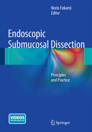 Endoscopic Submucosal Dissection | Bundesamt für magische Wesen
