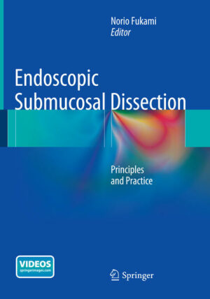 Endoscopic Submucosal Dissection | Bundesamt für magische Wesen