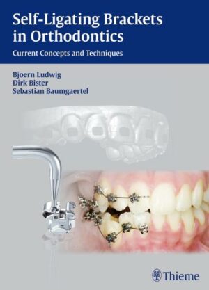 Self-ligating Brackets in Orthodontics | Bundesamt für magische Wesen