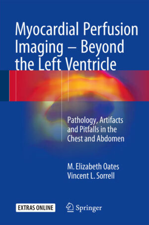 Myocardial Perfusion Imaging - Beyond the Left Ventricle | Bundesamt für magische Wesen