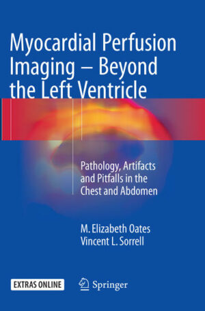 Myocardial Perfusion Imaging - Beyond the Left Ventricle | Bundesamt für magische Wesen