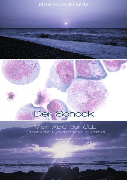 Warum ein Buch über eine Krankheit? „Nichts konzentriert die Gedanken besser als die bevorstehende Hinrichtung.“ (England) Logischerweise setze ich mich nicht nur mit der Leukämie, sondern auch mit meinem Leben auseinander. Und wenn eine Kollegin sagt: „Beim Lesen deines Buches (des ersten Buches „Powerhalse“) hat man den Eindruck, du stehst vor einem“, dann können doch später alle dieses Gefühl noch mal haben (dass ich da „war“). „Der Seele Grenzen kannst du nicht herausfinden und ob du jeglichen Weg abschreiten würdest, so tiefen Grund hat sie.“ (Heraklit) Also suche ich und suche. „Wer bin ich?“ und „Wer war ich?“ „Was ist meine Krankheit?“ „Was macht sie mit mir?“ Das will ich wissen. Was kann der Leser lernen? Gelassenheit im Umgang mit einer tödlichen Krankheit! Und es gibt ein „Ich“. Das verändert sich laufend und verschwindet mit dem Tod und ist abhängig von seiner Zeit, aber es ist! „Und wenn wir die ganze Welt durchforsten, um das Schöne zu finden, wir müssen es in uns tragen, sonst finden wir es nicht.“(Ralph Waldo Emerson) Nun habe ich mich auf die Suche nach dem Schönen begeben.