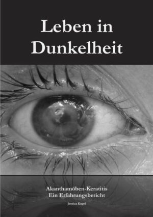 Jessica Kogel, am 10.05.1990 in Leipzig geboren, erkrankte 2011 an Akanthamöben-Keratits, einer seltenen Hornhauterkrankung, die meist Kontaktlinsenträger betrifft. Verdammt zu einem Leben in Dunkelheit und mit täglichen Schmerzen ohne zeitnahe Aussicht auf Heilung beschloss sie, dennoch nicht aufzugeben. Mit der Veröffentlichung ihres Blogs am 02.12.2011 legte Sie den Grundstein für erste öffentlich zugängliche Informationen. Dieses Buch richtet sich insbesondere an alle Betroffene dieser Krankheit, aber auch an deren Angehörige und Ärzte. Es zeigt beispielhaft einen Verlauf, steht mit Tipps und Informationen zur Seite und gibt Einblick in die Gedankenwelt von Jessica, während sie unter dieser Erkrankung litt.