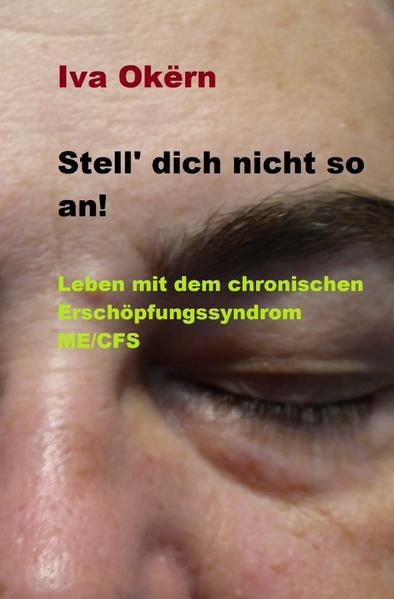 Hunderttausende Menschen leiden allein in Deutschland an der chronischen Erschöpfung ME/CFS. In Folge der Covid-Infektionen steigt die Zahl der Betroffenen. Die Erkrankung ist noch nicht genügend erforscht und wirft nach wie vor Fragen auf. Die Betroffenen führen inzwischen ein einsames Leben, ohne angemessene medizinische und sozialgesundheitliche Versorgung und mit dem folternden Satz „Stell' dich nicht so an“ konfrontiert. Iva Okërn gibt Einblicke in ihr Leben als ME/CFS, um auf die Krankheit und die bedenkliche Situation der Leidenden aufmerksam zu machen. Zahlreiche Tipps für Betroffene, Mitbetroffene und medizinisches Fachpersonal sowie eine humorvolle Erzählweise machen diese Beschreibung zu einem ebenso hilfreichen wie lesenswerten Buch.