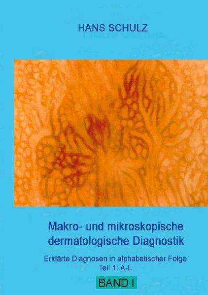 Praxisrelevante Hautkrankheiten, wie sie sich makro- und mikroskopisch phänotypisch darstellen, werden in alphabetischer Folge (Teil 1: A - L) im Bild demonstriert und erklärend beschrieben. Den Diagnosen sind zur besseren Übersicht und Orientierung einfach zu deutende Symbole vorangestellt, die auf die jeweilige zugrunde liegende Primäreffloreszenz hinweisen. Das Buch eignet sich als Nachschlagewerk besonders für Ärzte in der Ausbildung, poliklinische Visiten und Praxispersonal.