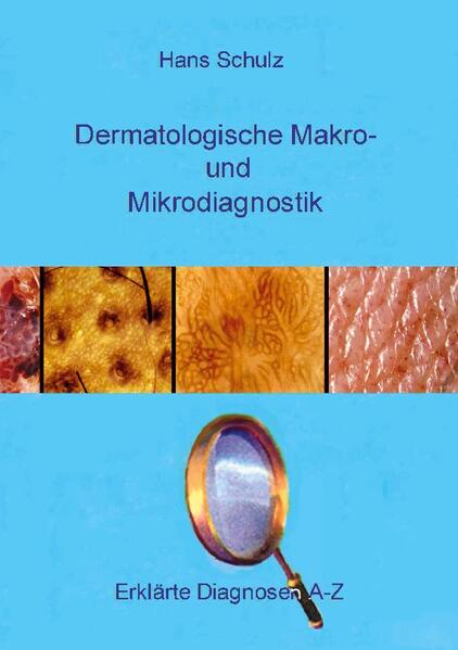 Praxisrelevante Hautkrankheiten, wie sie sich makro- und mikroskopisch phänotypisch darstellen, werden in alphabetischer Folge (A - Z) im Bild demonstriert und erklärend beschrieben. Den Diagnosen sind zur besseren Übersicht und Orientierung einfach zu deutende Symbole vorangestellt, die auf die jeweilige zugrunde liegende Primäreffloreszenz hinweisen. Das Buch eignet sich als Nachschlagewerk besonders für Ärzte in der Ausbildung, poliklinische Visiten, Allgemeinmediziner und Praxispersonal.