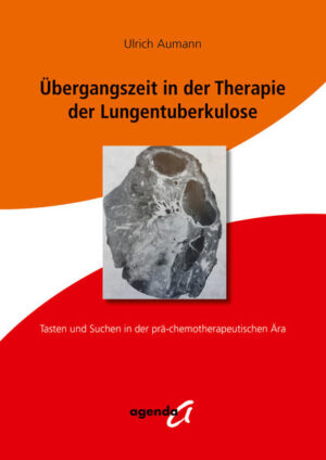 Übergangszeit in der Therapie der Lungentuberkulose | Bundesamt für magische Wesen