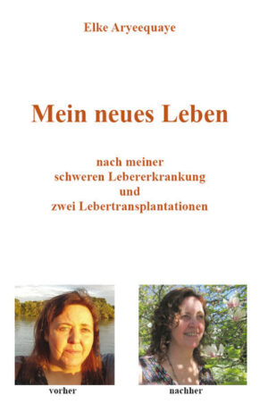 Elke Aryeequaye erzählt in ihrem Buch von ihrem medizinischen Leidensweg, der mit ersten gesundheitlichen Problemen beginnt nach einem Kampf um Leben und Tod und einer erfolgreichen Lebertransplantation endet. Halt findet die Autorin vor allem in ihrem Glauben an Gott, ihrer Familie und ihren Freunden, die ihr bei ihrem beschwerlichen Genesungsprozess uneingeschränkt zur Seite stehen.